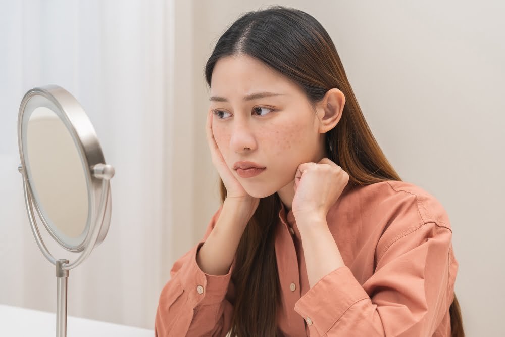 မျက်နှာချည်းပဲ ကွက်ပြီး မဲနေတာ ဘာကြောင့်လဲ