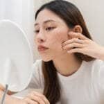 မျက်နှာမှာ ဝက်ခြံတွေ ဘာကြောင့်ဖြစ်ရတာလဲ!