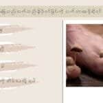 ခြေသည်းလက်သည်းမှိုပိုးဝင်တာကို သက်သာစေဖို့