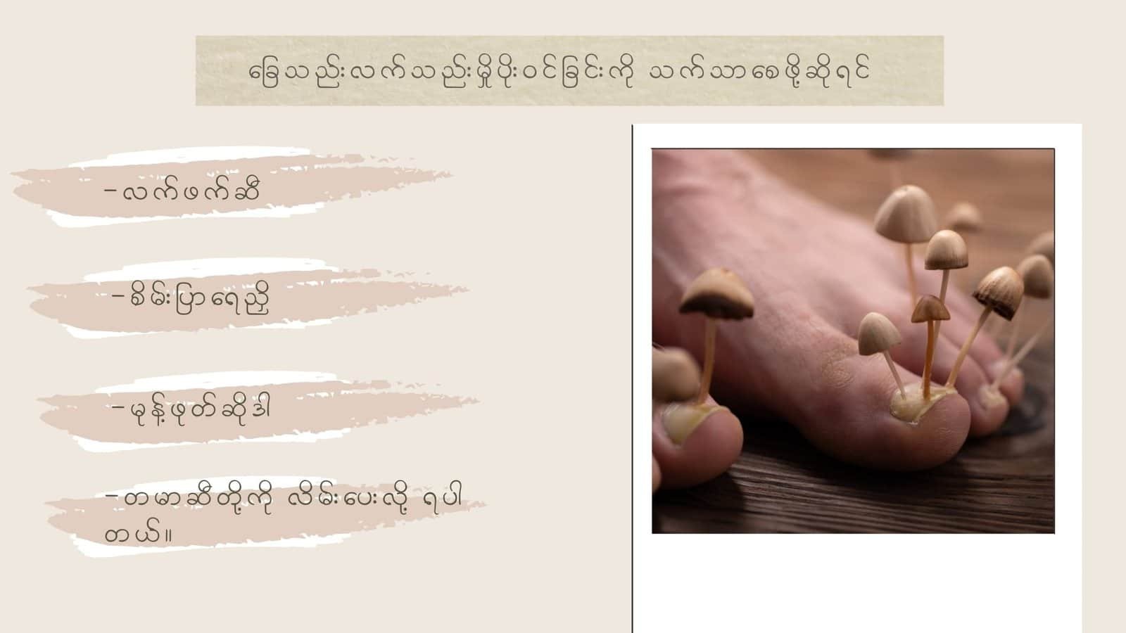 ခြေသည်းလက်သည်းမှိုပိုးဝင်တာကို သက်သာစေဖို့