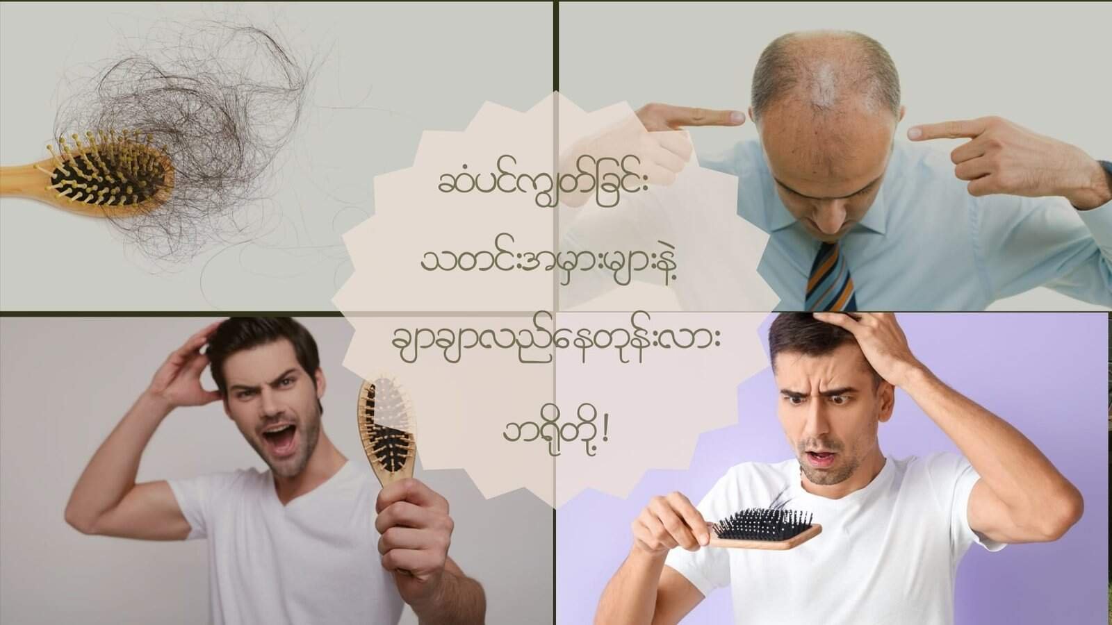 ဆံပင်ကျွတ်ရခြင်း သတင်းအမှားများနဲ့ ချာလည်လည်နေတုန်းလား ဘရို!