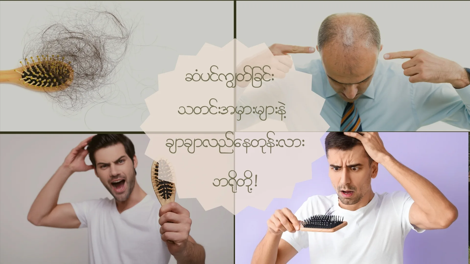 ဆံပင်ကျွတ်ရခြင်း သတင်းအမှားများနဲ့ ချာလည်လည်နေတုန်းလား ဘရို!