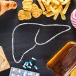 အသည်းအဆီဖုံးတာကို ဖြစ်စေနိုင်တဲ့ စားစရာတွေက ဘာတွေဖြစ်မလဲ!