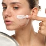 ဟော်မုန်းကြောင့်ဖြစ်တဲ့ ဝက်ခြံ