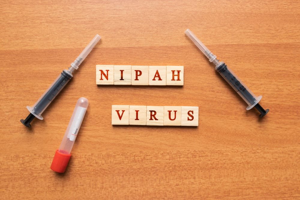 နီပါဗိုင်းရပ်စ် (Nipah virus ) ဘာတွေသိထားဖို့ လိုမလဲ!